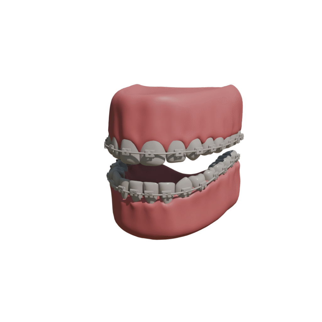 ceramic preview