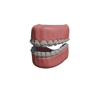 ceramic preview